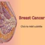 Breast Cancer – Animated Powerpoint Template ~ Free Medical Regarding Breast Cancer Powerpoint Template