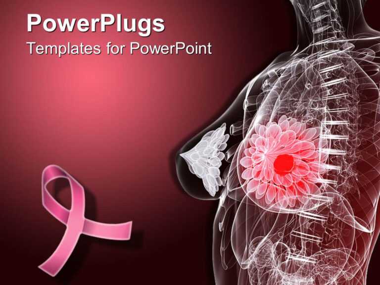 powerpoint presentation for breast cancer